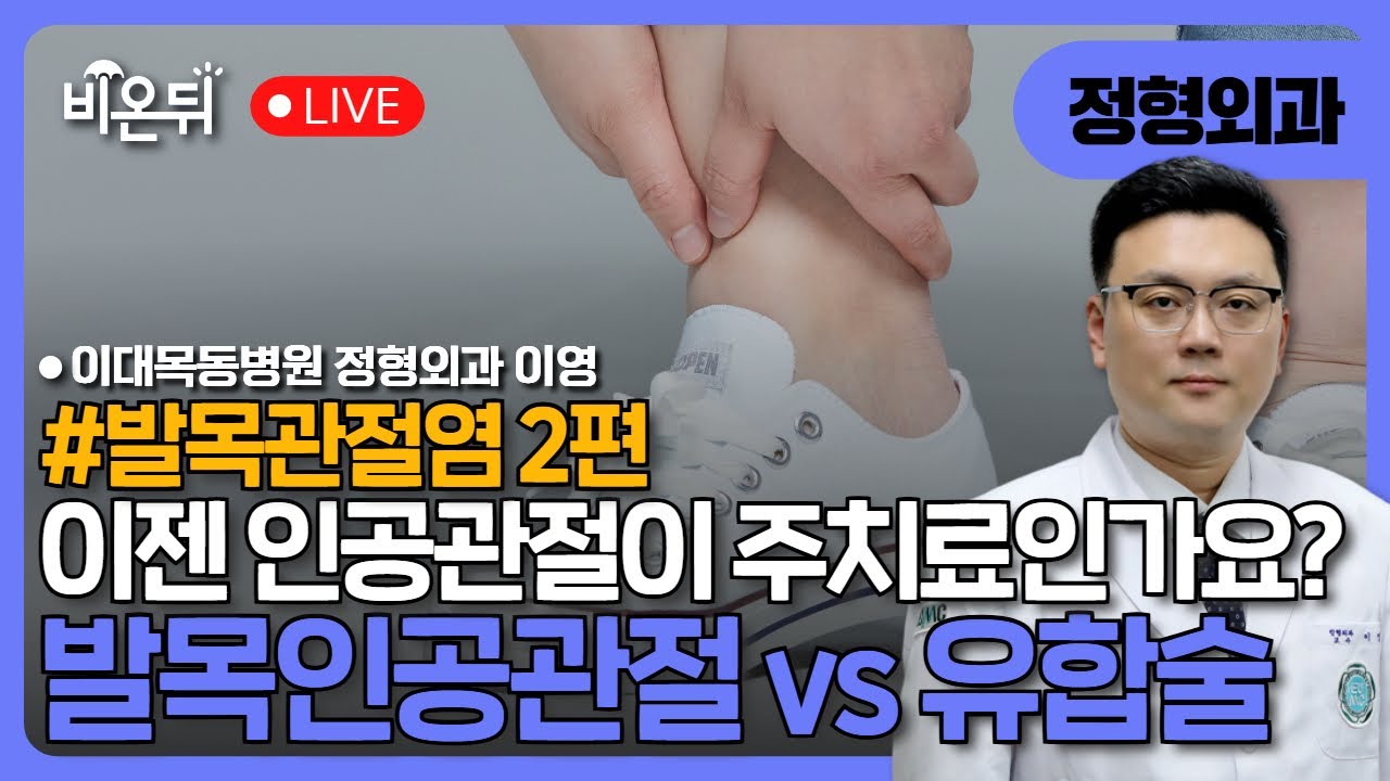 이젠 인공관절술이 주치료인가요? 발목인공관절 vs 유합술